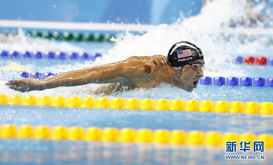 Phelps has obvious traces of cupping. Xinhua News Agency reporter Ding Xushe